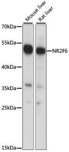 Epigenetics and Nuclear Signaling Antibodies 2 Anti-NR2F6 Antibody CAB15271