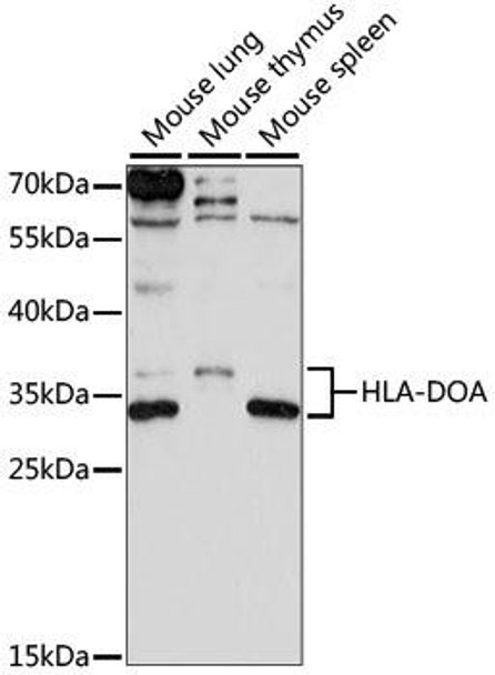 Immunology Antibodies 1 Anti-HLA-DOA Antibody CAB15277