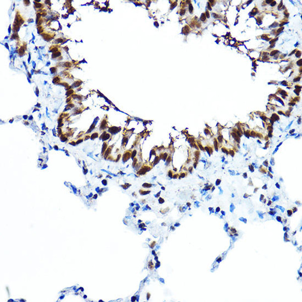 Epigenetics and Nuclear Signaling Antibodies 2 Anti-FOXA1 Antibody CAB15278