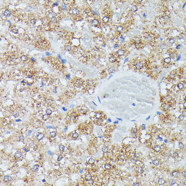 Metabolism Antibodies 1 Anti-IVD Antibody CAB15281