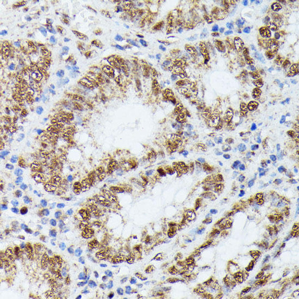 Cell Biology Antibodies 5 Anti-KIF22 Antibody CAB15285