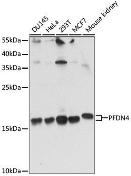 Cell Biology Antibodies 5 Anti-PFDN4 Antibody CAB15300