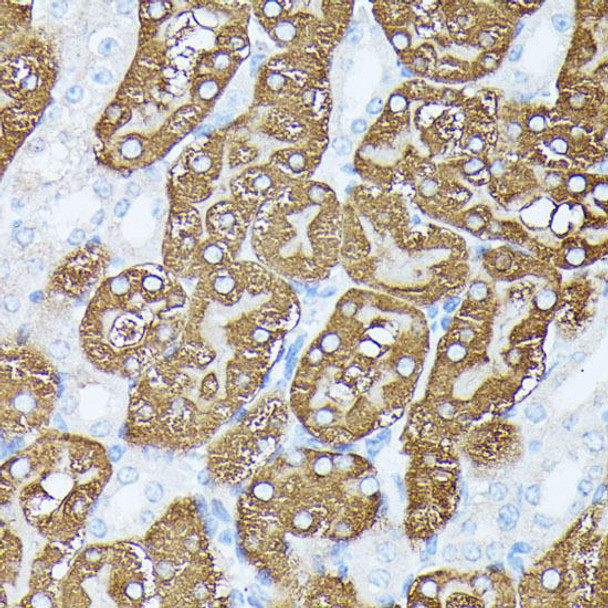 Cell Biology Antibodies 5 Anti-PLS1 Antibody CAB15303