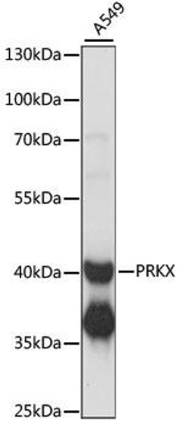 Cardiovascular Antibodies Anti-PRKX Antibody CAB15305