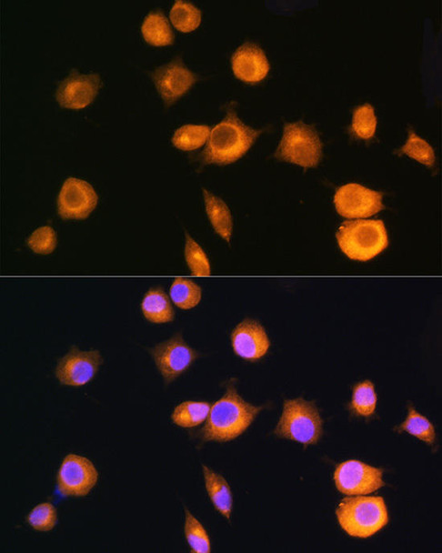 KO Validated Antibodies 1 Anti-PRKAR2A Antibody CAB1531KO Validated