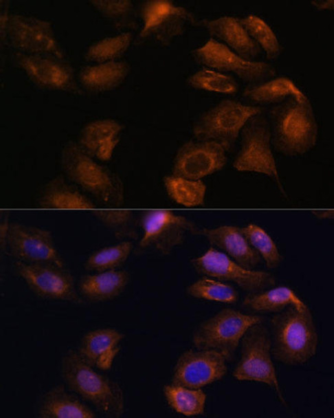 Cell Biology Antibodies 5 Anti-ROBO1 Antibody CAB15313