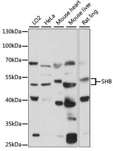 Cardiovascular Antibodies Anti-SHB Antibody CAB15318