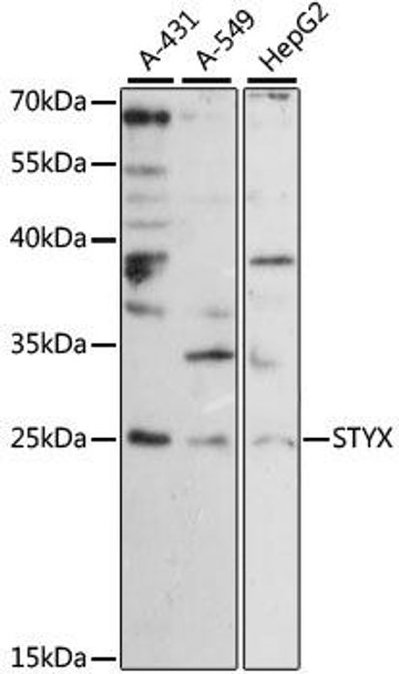 Cell Biology Antibodies 5 Anti-STYX Antibody CAB15320