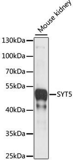 Cell Biology Antibodies 5 Anti-SYT5 Antibody CAB15321