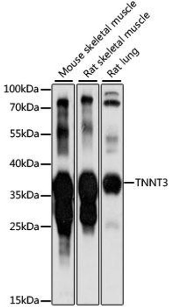 Cell Biology Antibodies 5 Anti-TNNT3 Antibody CAB15323