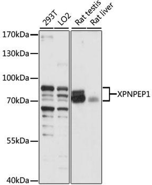 Metabolism Antibodies 1 Anti-XPNPEP1 Antibody CAB15326