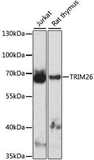 Immunology Antibodies 1 Anti-TRIM26 Antibody CAB15332