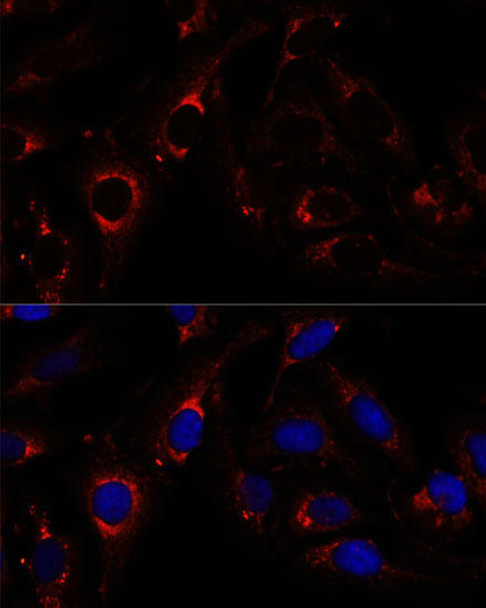 Neuroscience Anti-RNF112 Antibody CAB15333