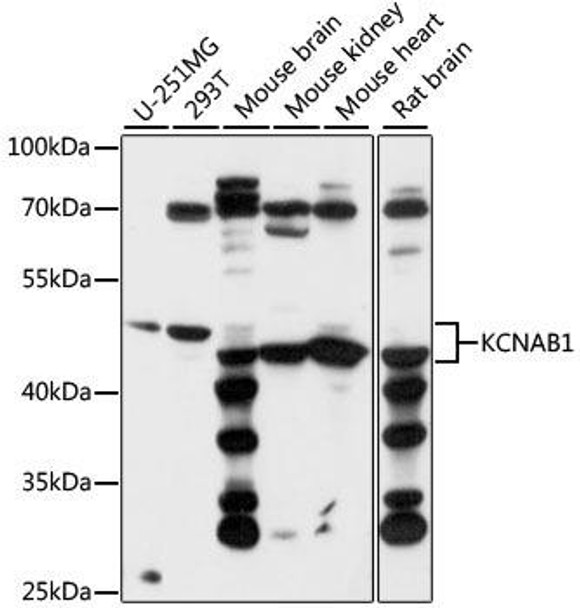 Signal Transduction Antibodies 2 Anti-KCNAB1 Antibody CAB15334