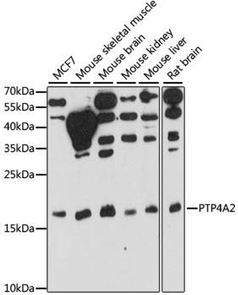 Cell Biology Antibodies 6 Anti-PTP4A2 Antibody CAB15335
