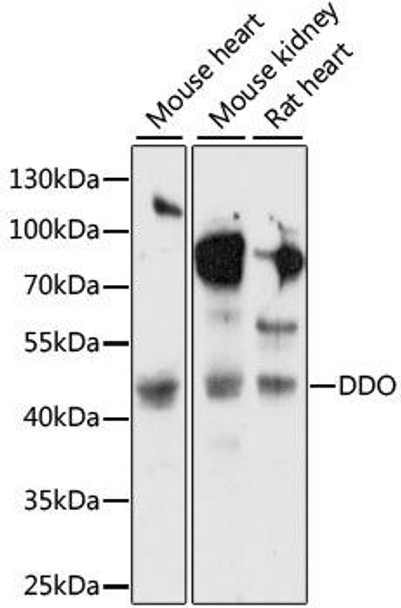 Cell Biology Antibodies 6 Anti-DDO Antibody CAB15338
