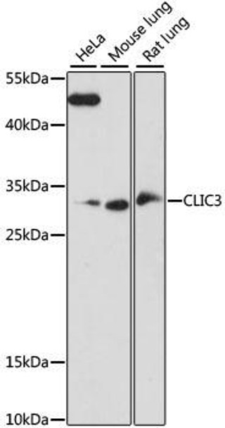 Signal Transduction Antibodies 2 Anti-CLIC3 Antibody CAB15347