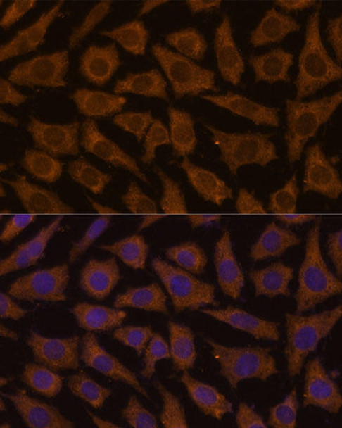 Cell Biology Antibodies 6 Anti-MTMR4 Antibody CAB15349