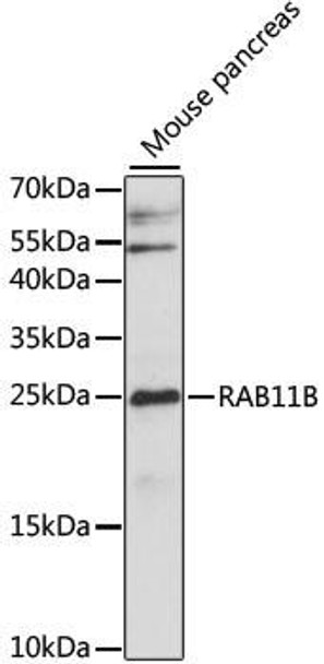 Cell Biology Antibodies 6 Anti-RAB11B Antibody CAB15350