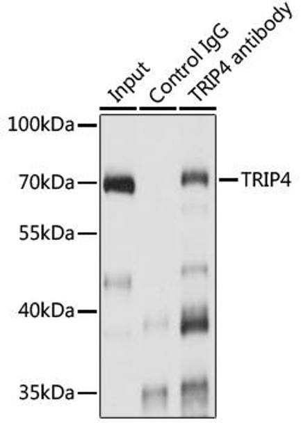 Epigenetics and Nuclear Signaling Antibodies 2 Anti-TRIP4 Antibody CAB15352