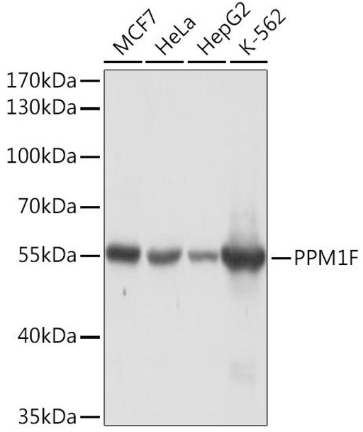 Cell Death Antibodies 1 Anti-PPM1F Antibody CAB15363