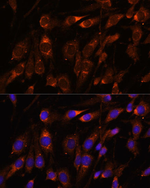 Metabolism Antibodies 1 Anti-FARSB Antibody CAB15375