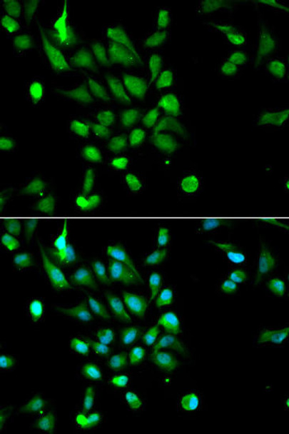 Cell Biology Antibodies 6 Anti-PSMC5 Antibody CAB1538