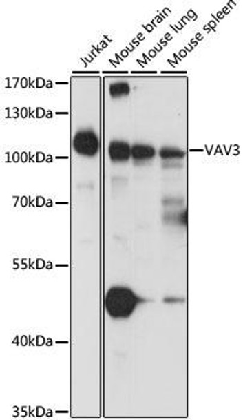 Cardiovascular Antibodies Anti-VAV3 Antibody CAB15385