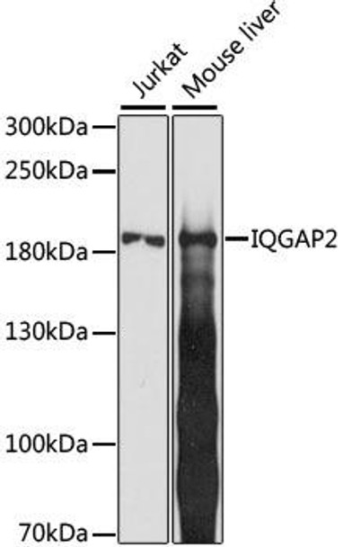 Cell Biology Antibodies 6 Anti-IQGAP2 Antibody CAB15392