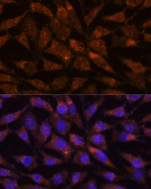 Cell Biology Antibodies 6 Anti-LMAN2 Antibody CAB15394