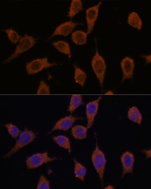 Cell Biology Antibodies 6 Anti-SEC23IP Antibody CAB15398