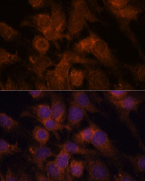 Cell Biology Antibodies 6 Anti-SEC23IP Antibody CAB15398