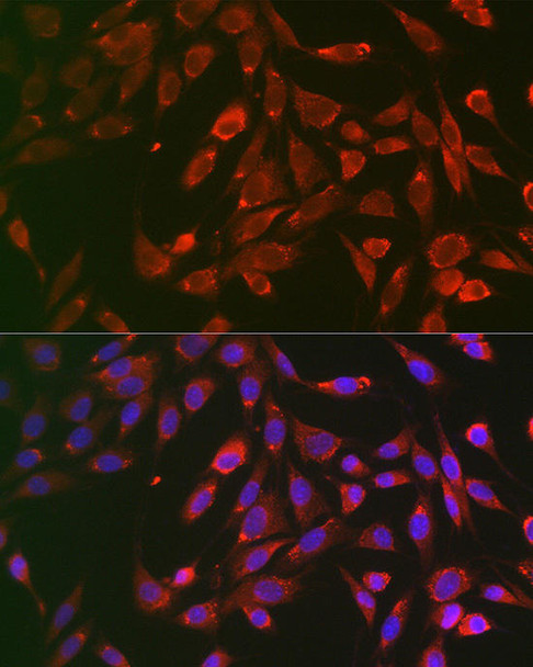 Cell Death Antibodies 1 Anti-TNFR1 Antibody CAB1540