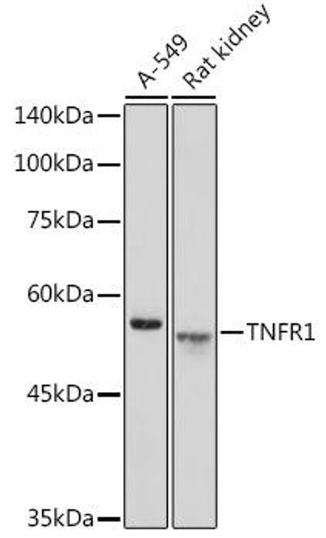 Cell Death Antibodies 1 Anti-TNFR1 Antibody CAB1540