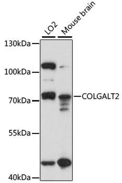 Signal Transduction Antibodies 2 Anti-COLGALT2 Antibody CAB15407