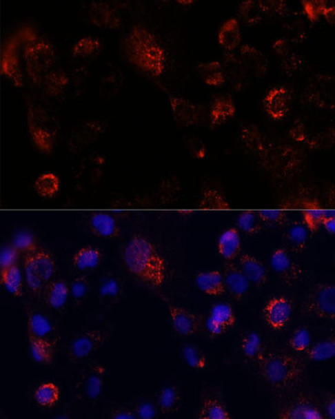 Cell Biology Antibodies 6 Anti-ACOT9 Antibody CAB15416