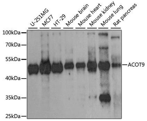 Cell Biology Antibodies 6 Anti-ACOT9 Antibody CAB15416