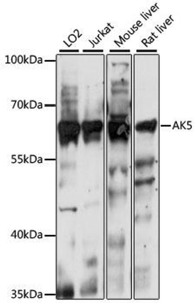 Signal Transduction Antibodies 2 Anti-AK5 Antibody CAB15424