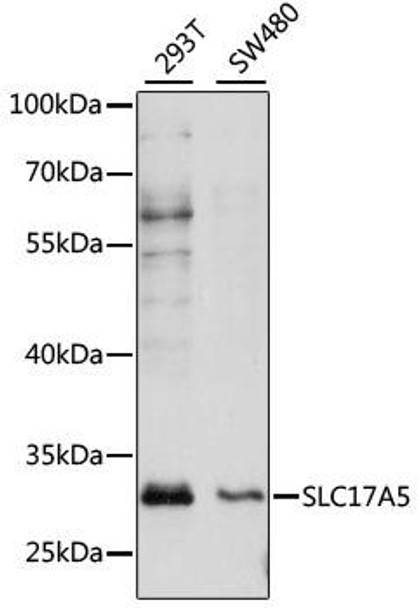 Signal Transduction Antibodies 2 Anti-SLC17A5 Antibody CAB15425