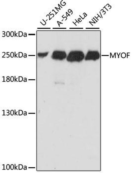 Cell Biology Antibodies 6 Anti-MYOF Antibody CAB15427