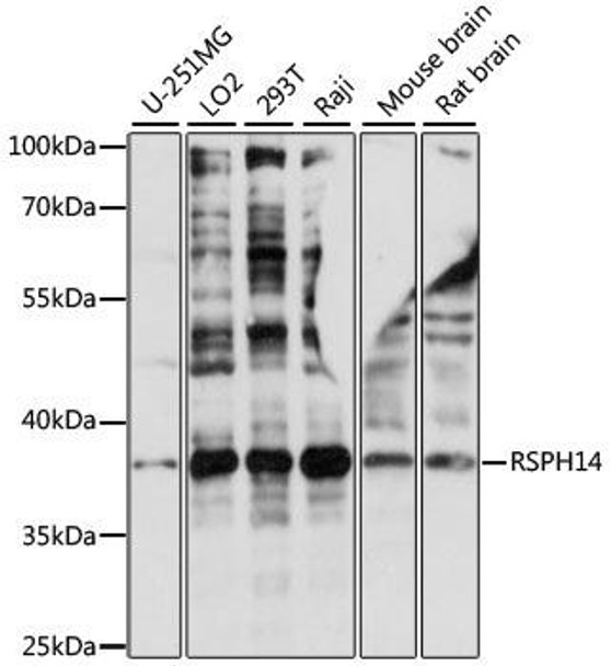 Cell Biology Antibodies 6 Anti-RSPH14 Antibody CAB15430