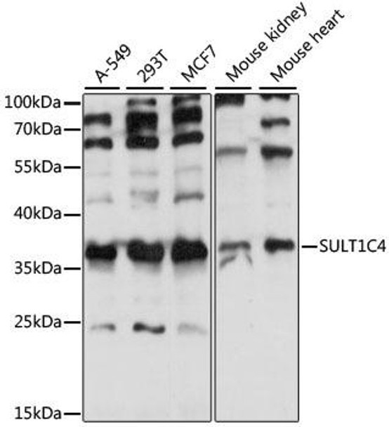 Cell Biology Antibodies 6 Anti-SULT1C4 Antibody CAB15433