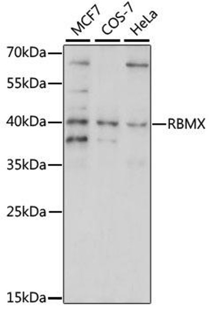 Epigenetics and Nuclear Signaling Antibodies 2 Anti-RBMX Antibody CAB15436