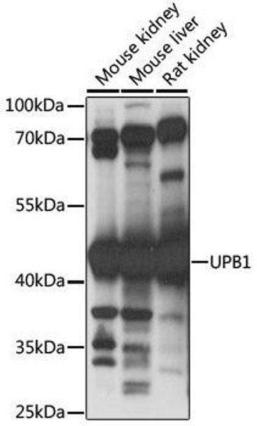 Cell Biology Antibodies 6 Anti-UPB1 Antibody CAB15452