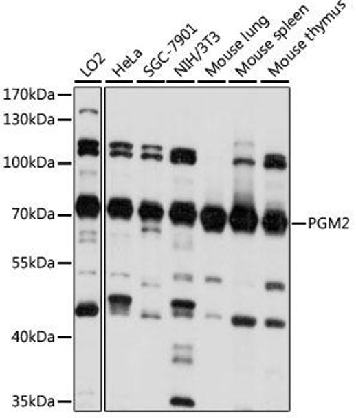 Metabolism Antibodies 1 Anti-PGM2 Antibody CAB15467