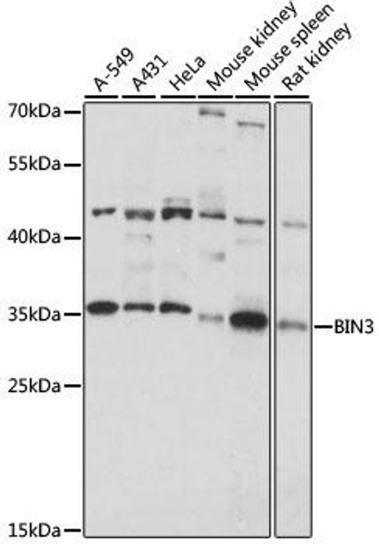 Cell Cycle Antibodies 1 Anti-BIN3 Antibody CAB15478