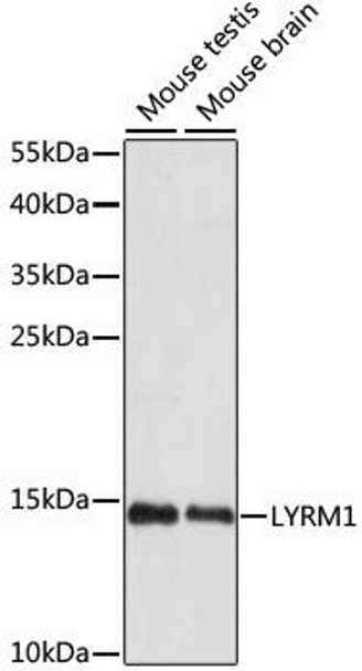 Signal Transduction Antibodies 2 Anti-LYRM1 Antibody CAB15483