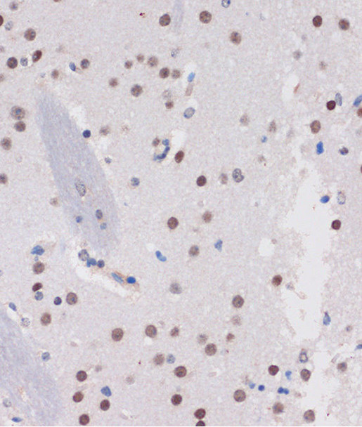 Neuroscience Anti-ARID1B Antibody CAB15488