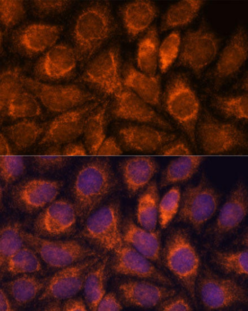 Epigenetics and Nuclear Signaling Antibodies 2 Anti-MRPS14 Antibody CAB15498