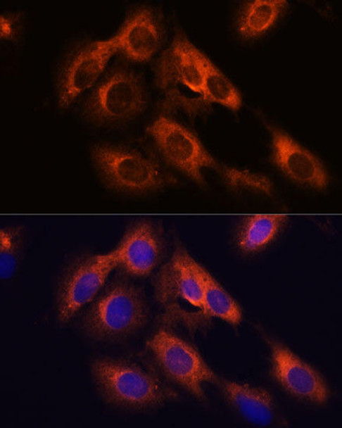 Cell Biology Antibodies 6 Anti-RAPH1 Antibody CAB15506